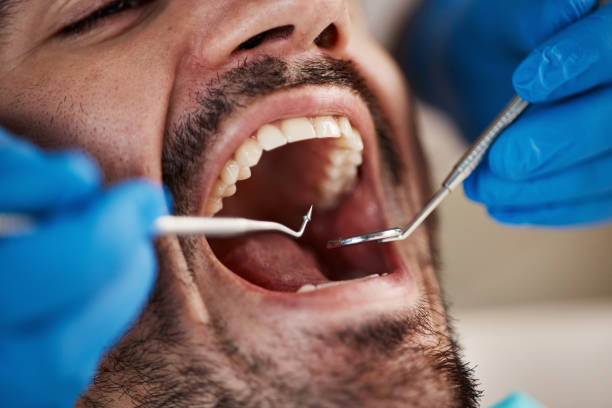 Best Emergency Gum Treatment in Morrow, GA