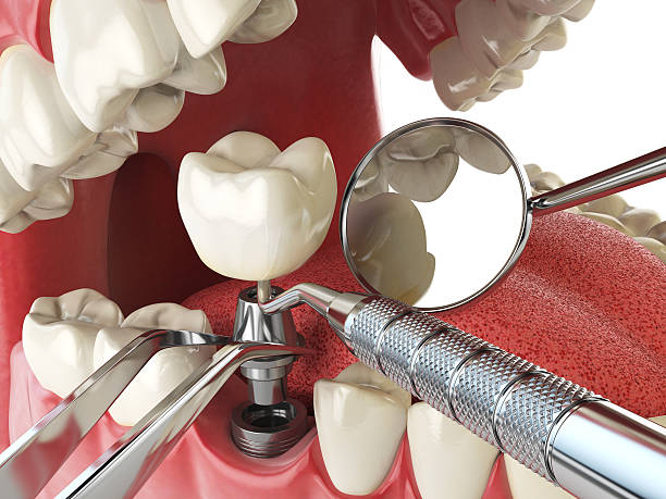 Best Cosmetic Emergency Dentistry in Morrow, GA