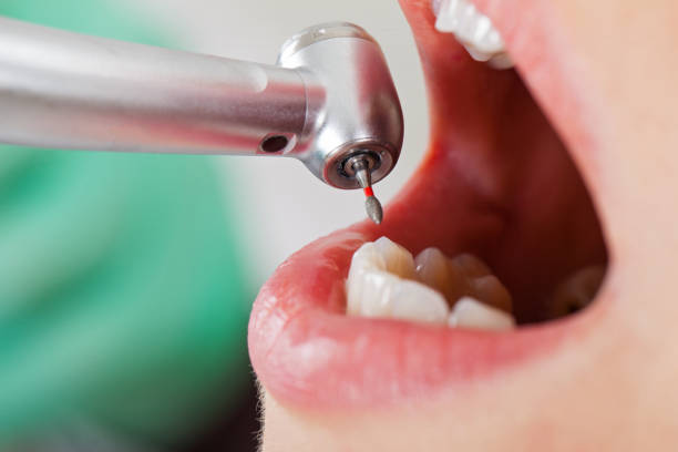 Best Emergency Dental Care for Broken or Chipped Teeth in Morrow, GA